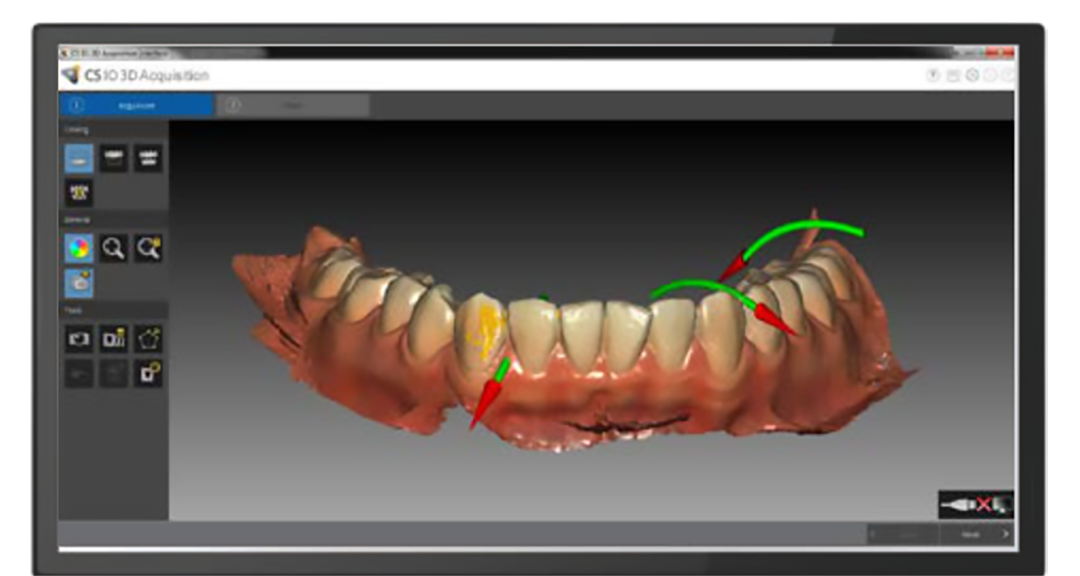 Impronta 3D digitale